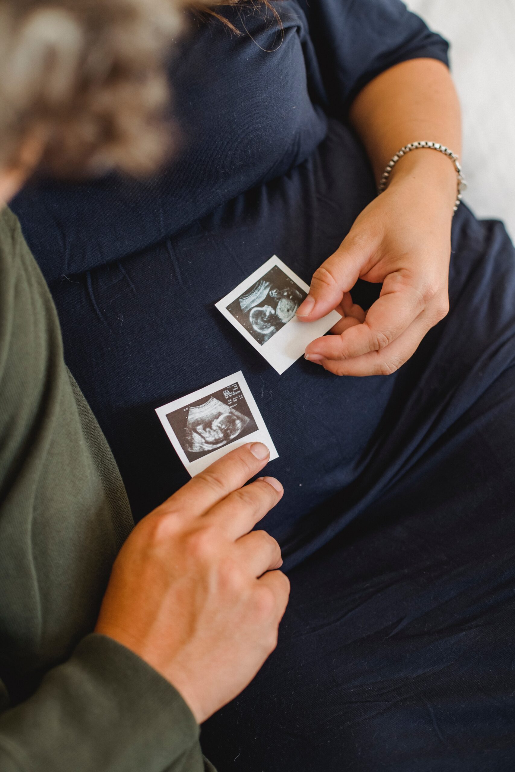L'ecografia ostetrica - il primo incontro con il tuo bambino - Bodee